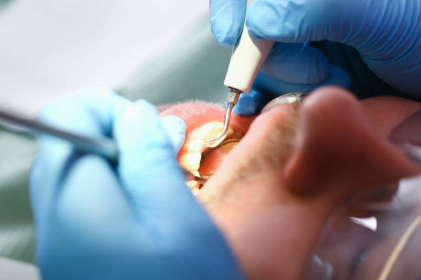 Best Emergency Treatment for Toothache in Trail Creek, IN