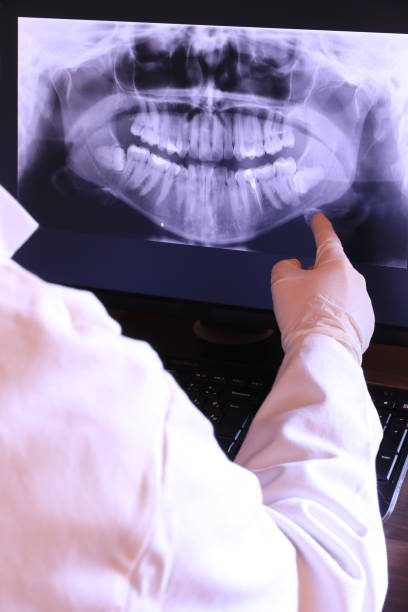 Best Emergency Tooth Extraction in Trail Creek, IN