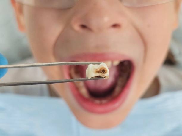Best Emergency Treatment for Toothache in Trail Creek, IN