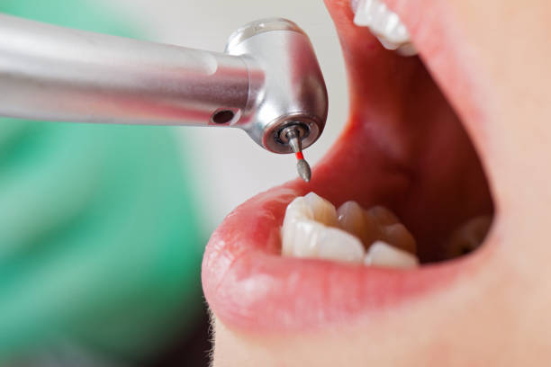 Best Weekend Emergency Dentist in Trail Creek, IN